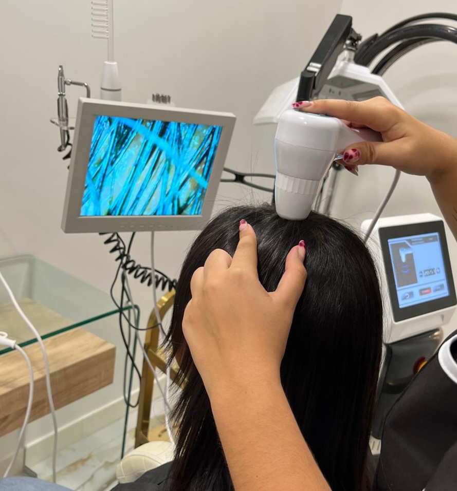 Diagnostiquer sa perte de cheveux